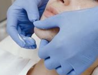 Chin waxing
